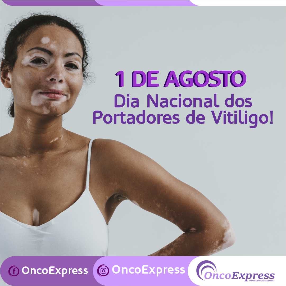 1 de agosto. Dia nacional dos portadores de vitiligo - OncoExpress