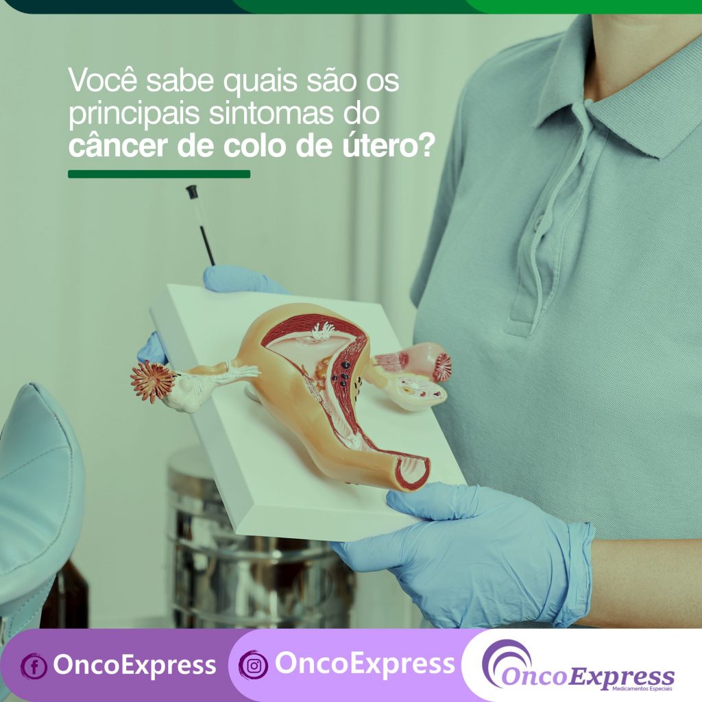 Você Sabe Quais São Os Principais Sintomas Do Câncer De Colo De útero Oncoexpress 6978