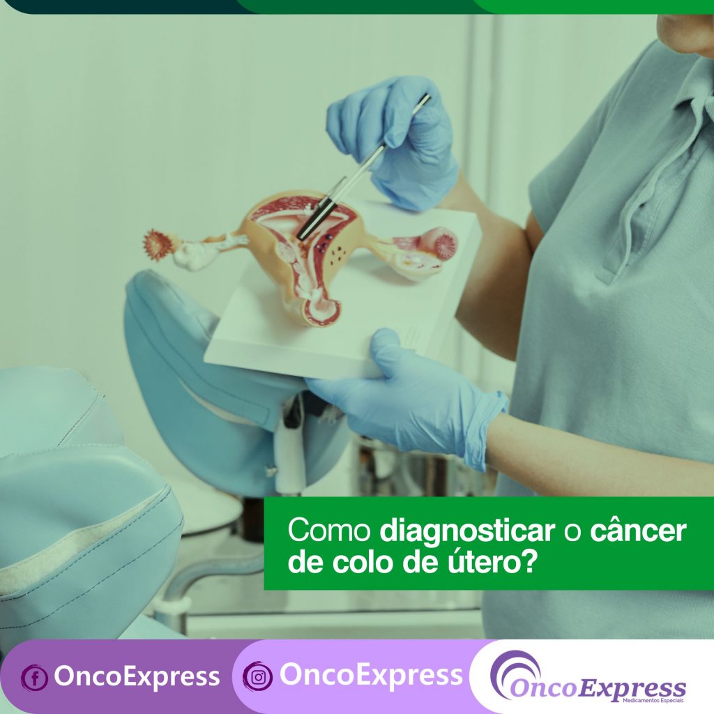 Como Diagnosticar O Câncer De Colo De útero Oncoexpress